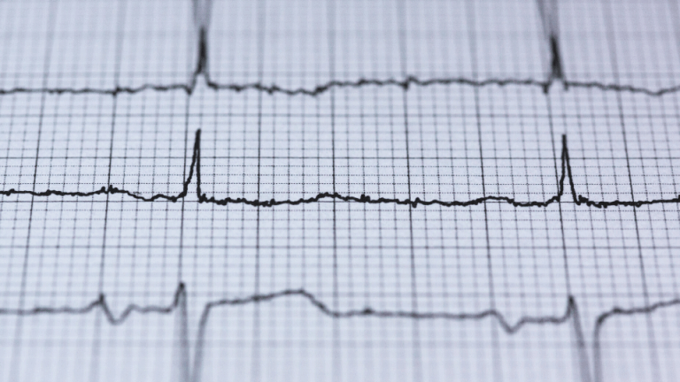 AMCA Data Breach Displays Importance of Cybersecurity in Healthcare
